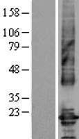 Claudin 4 (CLDN4) Human Over-expression Lysate