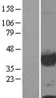 Calponin (CNN1) Human Over-expression Lysate