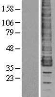 CCR1 Human Over-expression Lysate
