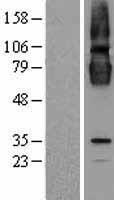 CLPTM1 Human Over-expression Lysate
