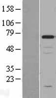 Chromogranin A (CHGA) Human Over-expression Lysate