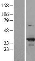 CDK6 Human Over-expression Lysate