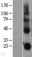 CD70 Human Over-expression Lysate
