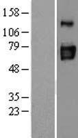 ENTPD3 Human Over-expression Lysate