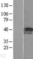 Cyclin E1 (CCNE1) Human Over-expression Lysate