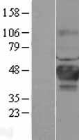 CA12 Human Over-expression Lysate