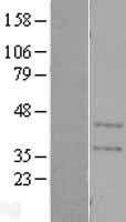 Carbonic Anhydrase XI (CA11) Human Over-expression Lysate