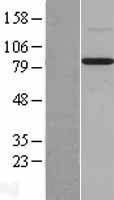 BMP1 Human Over-expression Lysate