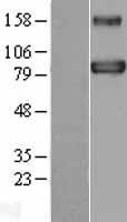BACH1 Human Over-expression Lysate