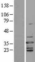 D4 (ARHGDIB) Human Over-expression Lysate