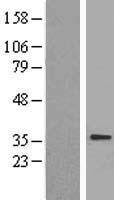 SLC25A4 Human Over-expression Lysate