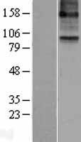 15 Lipoxygenase 2 (ALOX15B) Human Over-expression Lysate