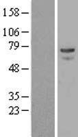 alpha 1 Fetoprotein (AFP) Human Over-expression Lysate