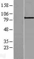 ABP1 (AOC1) Human Over-expression Lysate
