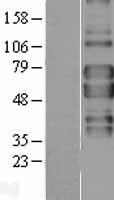 TNFRSF1B Human Over-expression Lysate