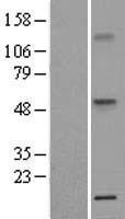TNFRSF1A Human Over-expression Lysate