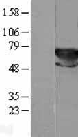 Transketolase (TKT) Human Over-expression Lysate