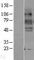 Serotonin transporter (SLC6A4) Human Over-expression Lysate