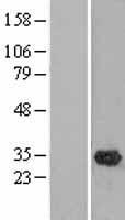 OLAH Human Over-expression Lysate