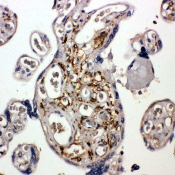 Bag5 Rabbit Polyclonal Antibody