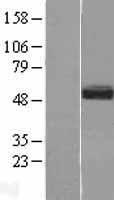 SMOC1 Human Over-expression Lysate