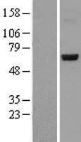 CERKL Human Over-expression Lysate