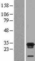Ecat1 (KHDC3L) Human Over-expression Lysate