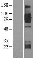 TrkB (NTRK2) Human Over-expression Lysate