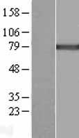 Calcium independent Phospholipase A2 (PLA2G6) Human Over-expression Lysate