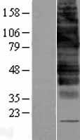 GLUT9 (SLC2A9) Human Over-expression Lysate