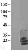 RPL28 Human Over-expression Lysate