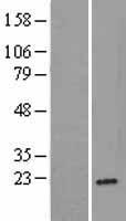 Ribosomal protein L26 (RPL26) Human Over-expression Lysate