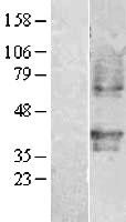 PAF Receptor (PTAFR) Human Over-expression Lysate