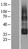 Prostaglandin I2 Receptor (PTGIR) Human Over-expression Lysate