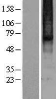 Mu Opioid Receptor (OPRM1) Human Over-expression Lysate