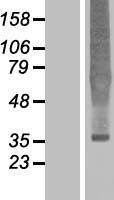 Delta Opioid Receptor (OPRD1) Human Over-expression Lysate