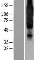 NPY1R Human Over-expression Lysate