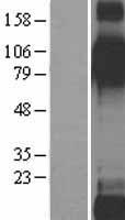 ITGB6 Human Over-expression Lysate