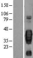 SCF (KITLG) Human Over-expression Lysate