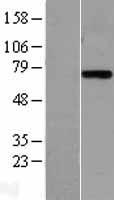 Plasma Kallikrein 1B (KLKB1) Human Over-expression Lysate