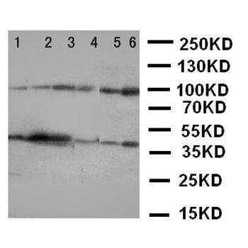 NFkB/NFKB1 p105/p50 Rabbit Polyclonal Antibody