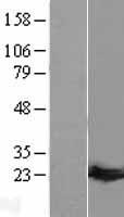 Guanylate kinase (GUK1) Human Over-expression Lysate