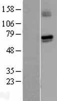 GUCY1A1 Human Over-expression Lysate