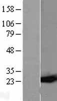 GST3 (GSTP1) Human Over-expression Lysate