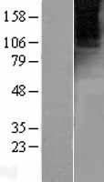 Metabotropic Glutamate Receptor 4 (GRM4) Human Over-expression Lysate