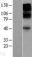 GABA A Receptor beta 3 (GABRB3) Human Over-expression Lysate