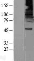 GABA A Receptor beta 2 (GABRB2) Human Over-expression Lysate