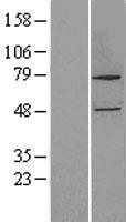 CYP27B1 Human Over-expression Lysate