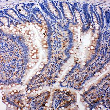 SMAD5 Rabbit Polyclonal Antibody