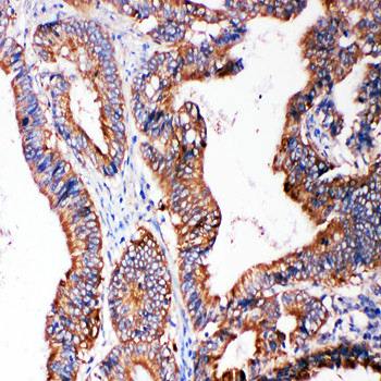 SMAD5 Rabbit Polyclonal Antibody